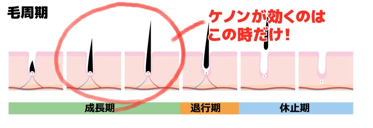 毛周期の中でケノンが効果的なのは「生えはじめ」だけ